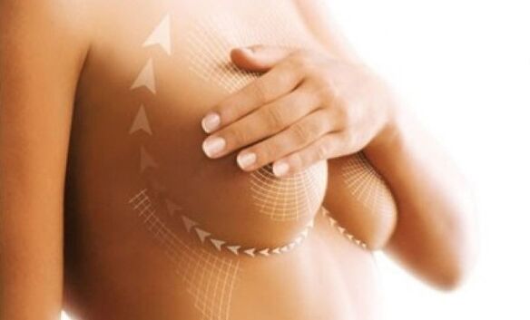 Lifting della sutura per l'ingrandimento del seno