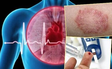 Controindicazioni per l'autorità per le labbra